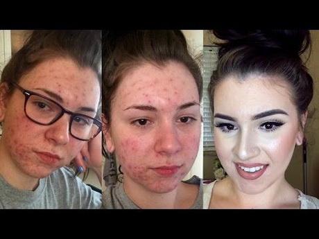 makeup-tutorial-for-teenagers-with-acne-67_10 Make-up les voor tieners met acne