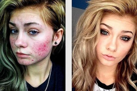 makeup-tutorial-for-teenagers-with-acne-67_11 Make-up les voor tieners met acne