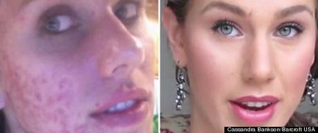 makeup-tutorial-for-teenagers-with-acne-67_12 Make-up les voor tieners met acne