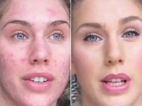 makeup-tutorial-for-teenagers-with-acne-67_4 Make-up les voor tieners met acne
