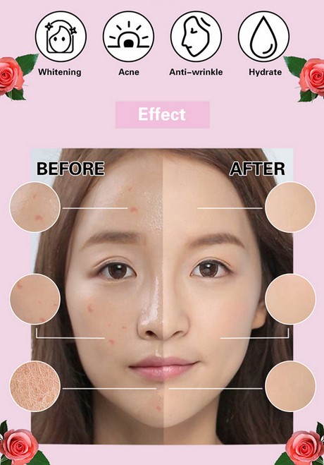 makeup-tutorial-2022-acne-76_10 Make-up tutorial 2022 acne