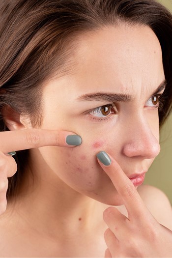 makeup-tutorial-2022-acne-76_14 Make-up tutorial 2022 acne