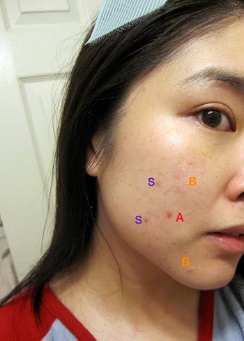 Make - up tutorial voor acne littekens