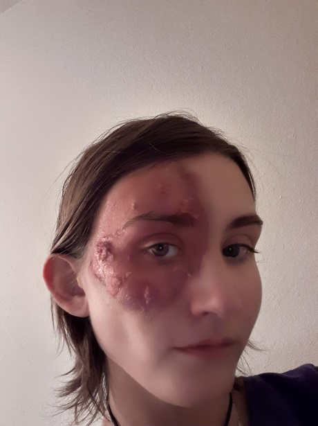 makeup-tutorial-for-acne-scars-14_7 Make - up tutorial voor acne littekens