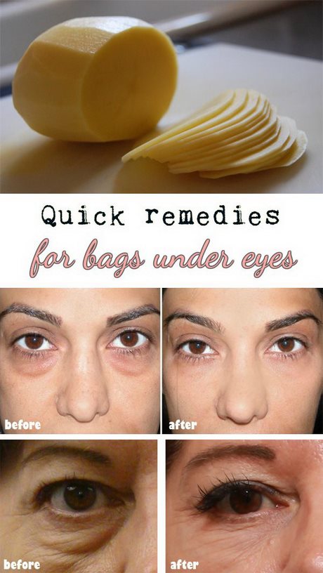 baggy-eyes-makeup-tutorial-83_12 Baggy ogen make-up tutorial