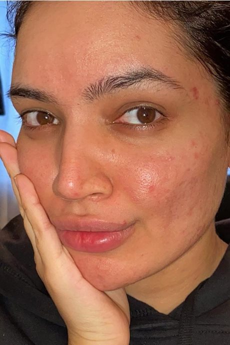 makeup-tutorial-for-acne-53_11 Make - up tutorial voor acne