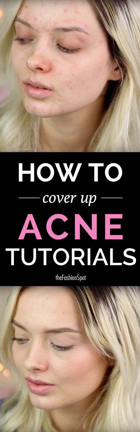 makeup-tutorial-for-acne-53_6 Make - up tutorial voor acne