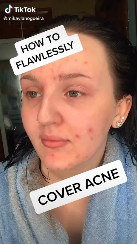Dagelijkse make-up tutorial acne