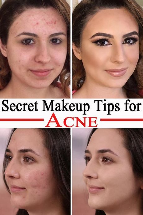 Acne make-up tips