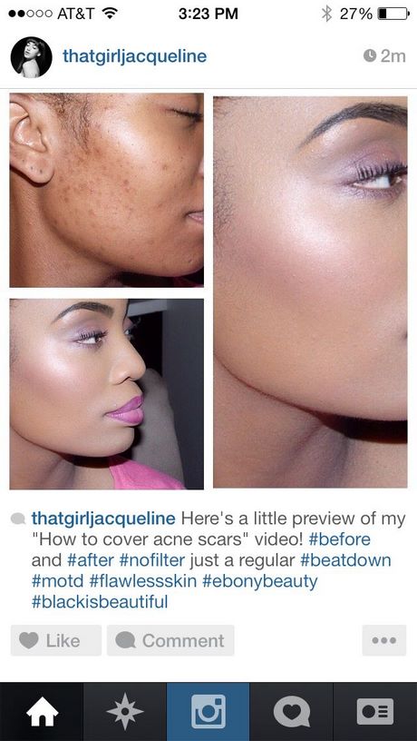 acne-makeup-tips-31_15 Acne make-up tips