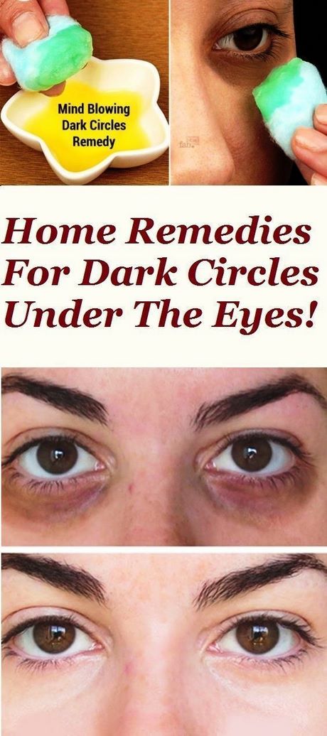 makeup-tips-for-dark-circles-under-eyes-41_11 Make-up tips voor donkere cirkels onder ogen