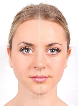 makeup-tutorial-for-acne-prone-skin-28_13 Make - up tutorial voor acne gevoelige huid