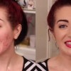 Scar cover up make-up tutorial